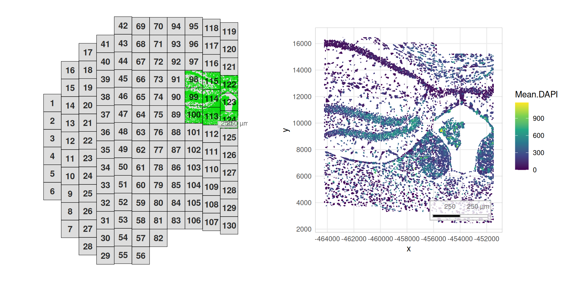 19 Quality control – Orchestrating Spatial Transcriptomics Analysis ...