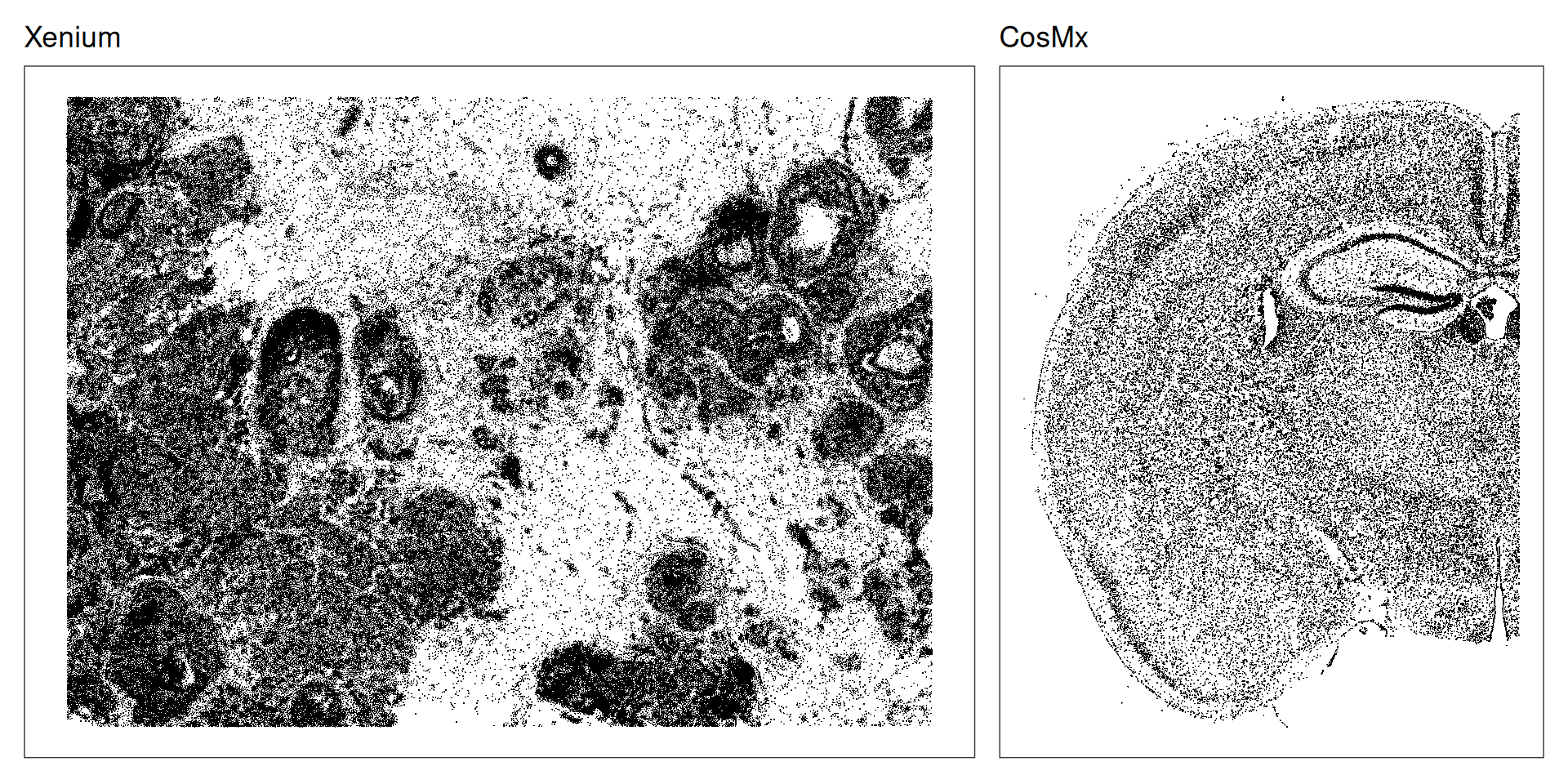 19 Quality control – Orchestrating Spatial Transcriptomics Analysis ...