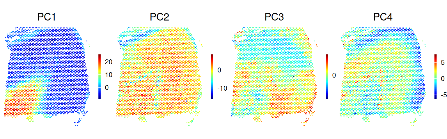 11 Intermediate processing – Orchestrating Spatial Transcriptomics ...